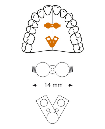 Fan-type screw 2 Pieces