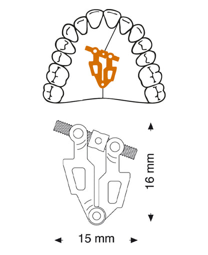 Asymmetric fan-type screw