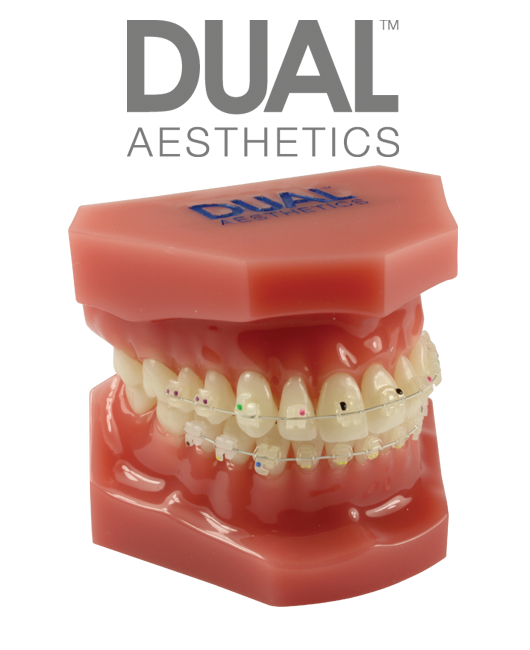 Consultation Model with Dual™ Ceramic Brackets