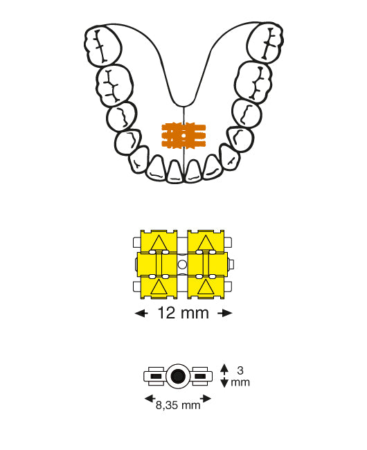 Pop Screw Universal