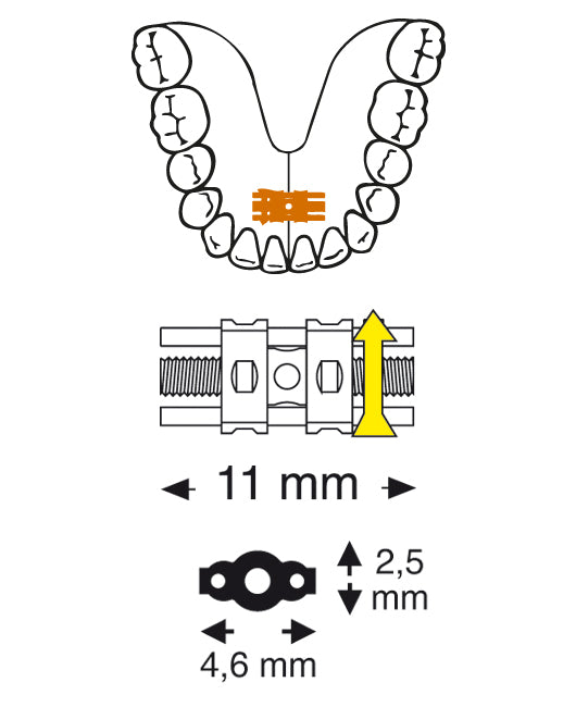 Super Micro Screw