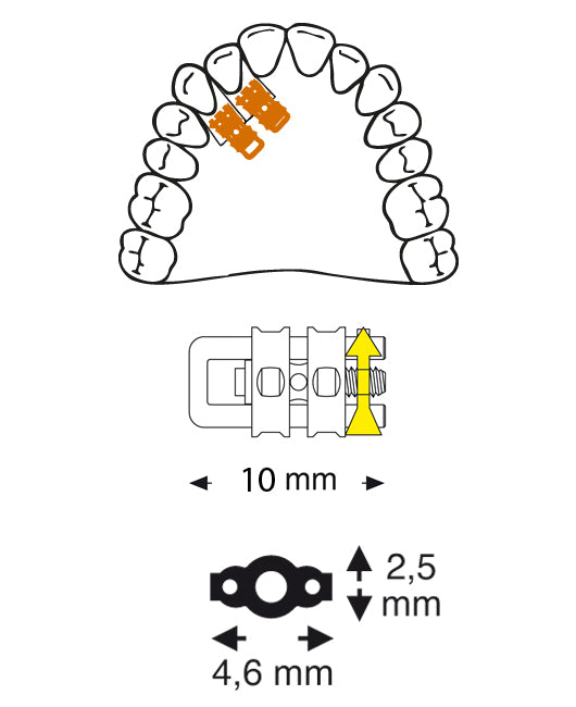 Super Micro Sectional Screw