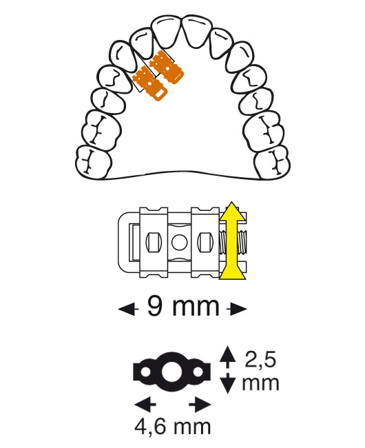 Super Micro Sectional Screw