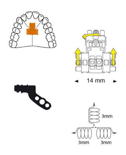 Three Directional Screw Anatomical