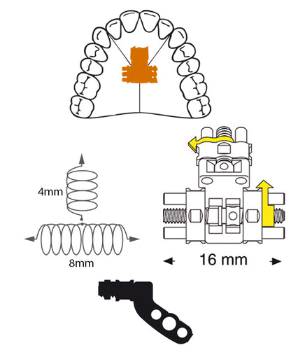 Three Directional Screw Anatomical