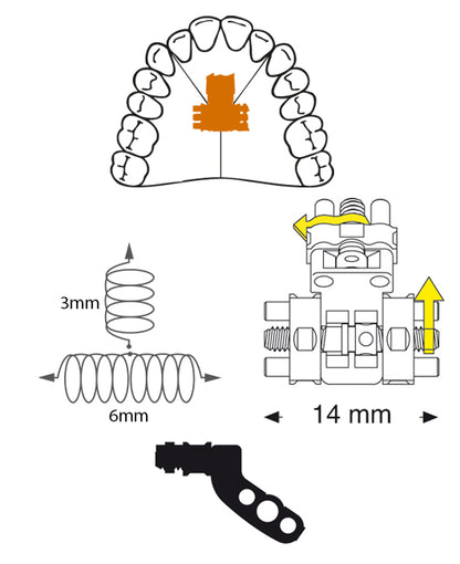 Three Directional Screw Anatomical