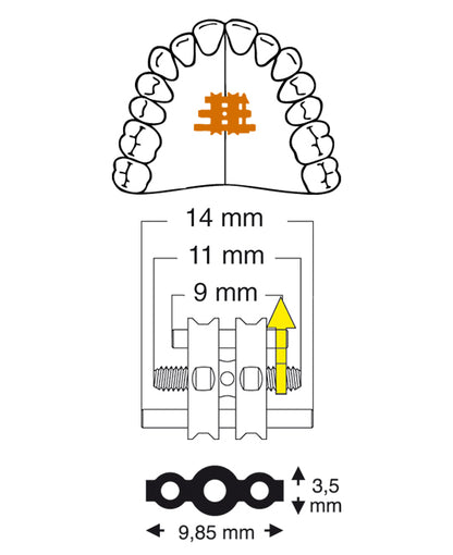 Trapezoidal Screw