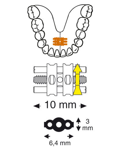 Universal Screw