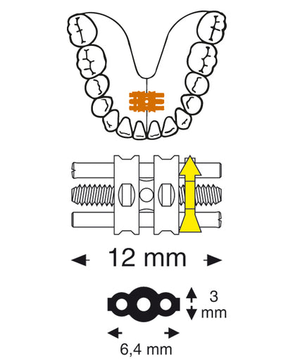 Universal Screw